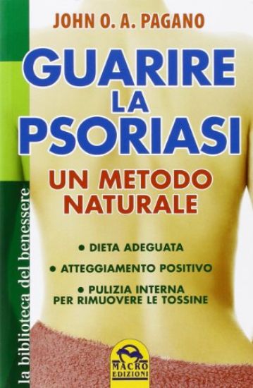 Immagine di GUARIRE LA PSORIASI - UN METODO NATURALE