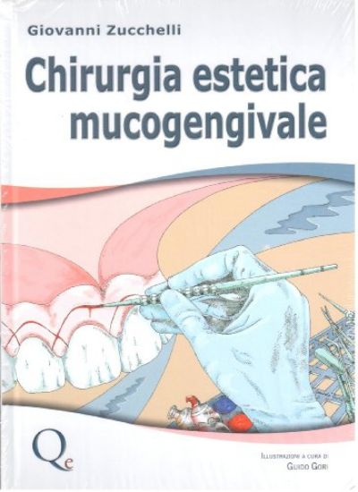 Immagine di CHIRURGIA ESTETICA MUCOGENGIVALE