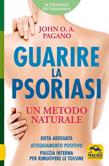 Immagine di GUARIRE LA PSORIASI. UN METODO NATURALE